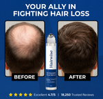Hairwise™ Advanced Hair Growth System