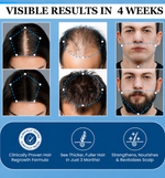 Hairwise™ Advanced Hair Growth System
